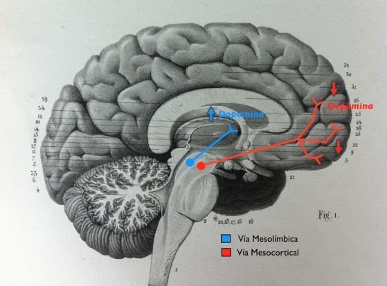 Afectación de las Vías Mesolímbica y Mesocortical en la Esquizofrenia. Responsable de los Síntomas Positivos y Negativos Respectivamente.